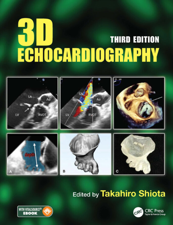 3D Echocardiography 3D Echocardiography
