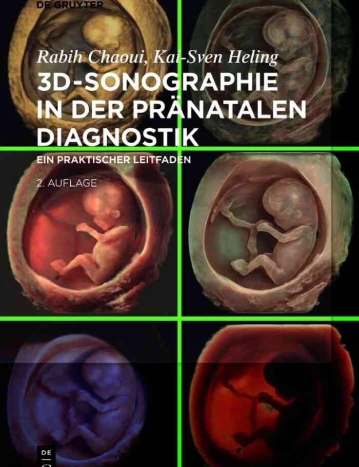 3D-Sonographie in der pränatalen Diagnostik: Ein praktischer Leitfaden 3D-Sonographie in der pränatalen Diagnostik: Ein praktischer Leitfaden