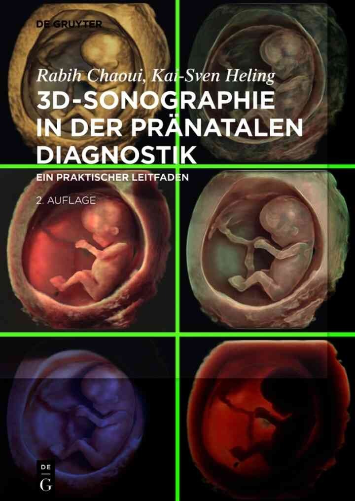 3D-Sonographie in der prÃ¤natalen Diagnostik: Ein praktischer Leitfaden