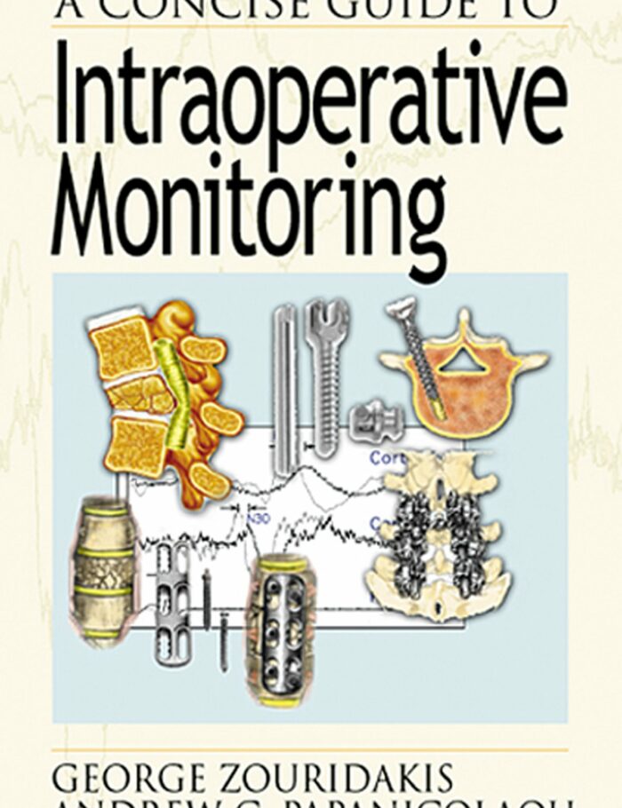 A Concise Guide to Intraoperative Monitoring A Concise Guide to Intraoperative Monitoring