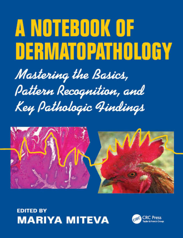 A Notebook of Dermatopathology: Mastering the Basics, Pattern Recognition, and Key Pathologic Findings