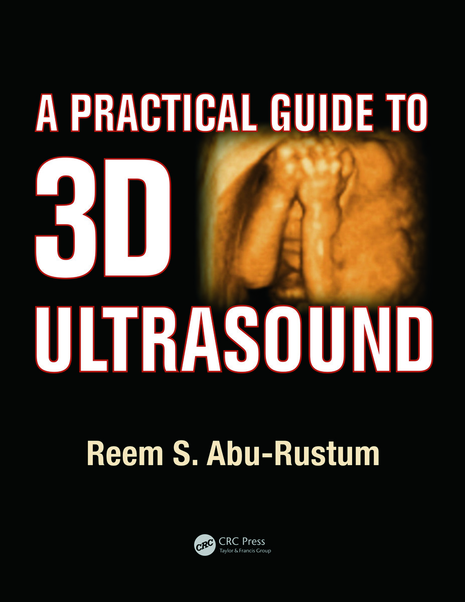 A Practical Guide to 3D Ultrasound