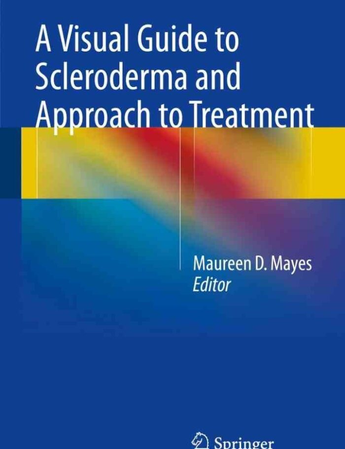 A Visual Guide to Scleroderma and Approach to Treatment