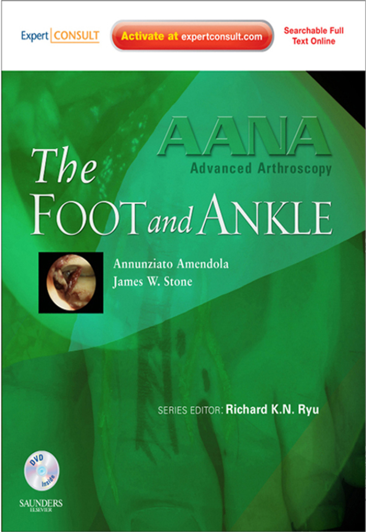 AANA Advanced Arthroscopy: The Foot and Ankle - Electronic
