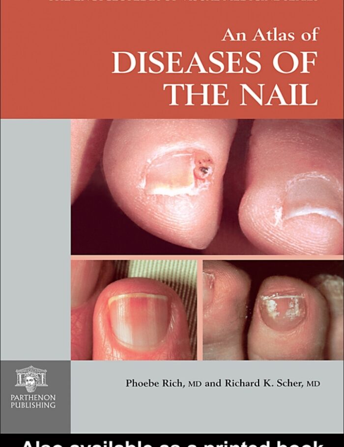 An Atlas of Diseases of the Nail