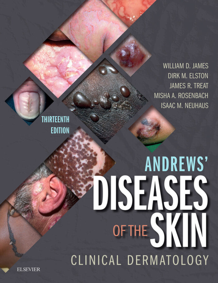 Andrews' Diseases of the Skin Clinical Dermatology