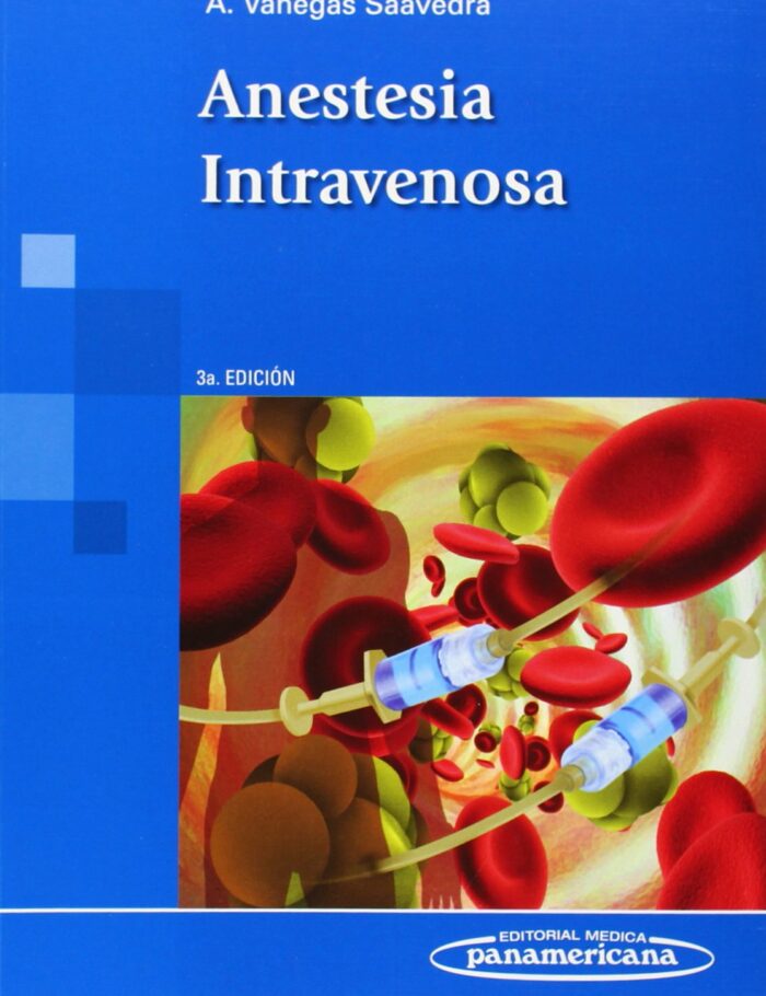 Anestesia intravenosa