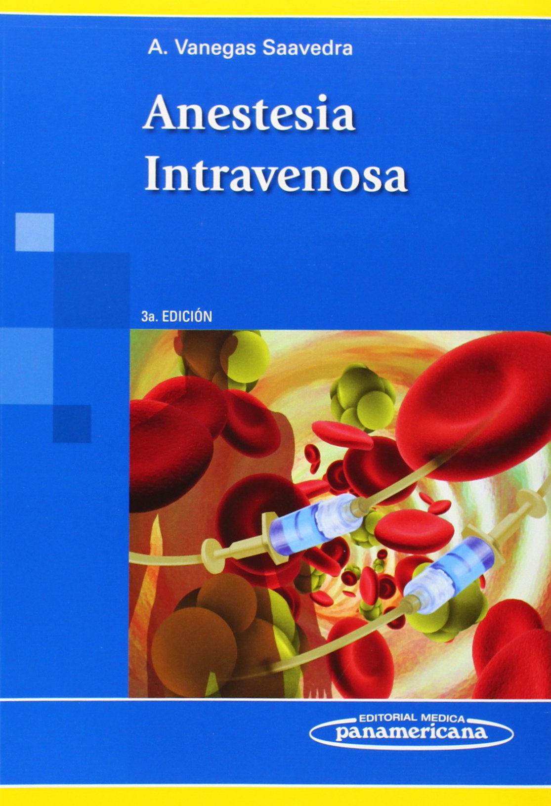 Anestesia intravenosa