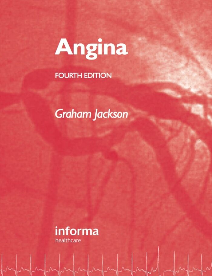 Angina