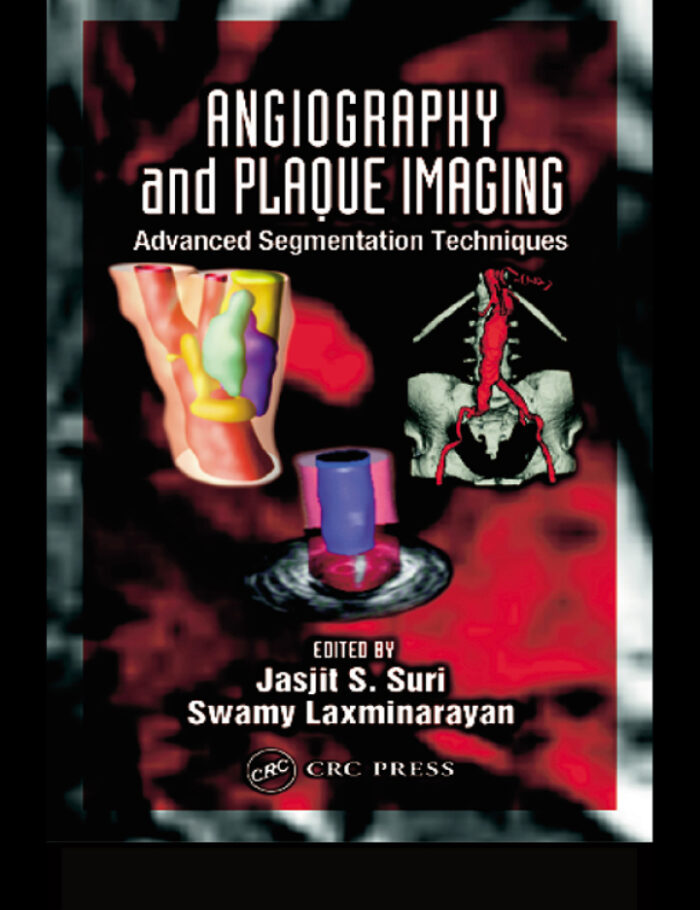 Angiography and Plaque Imaging: Advanced Segmentation Techniques