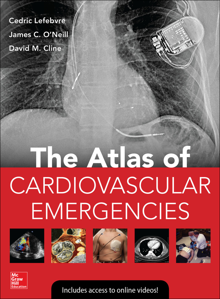 Atlas of Cardiovascular Emergencies