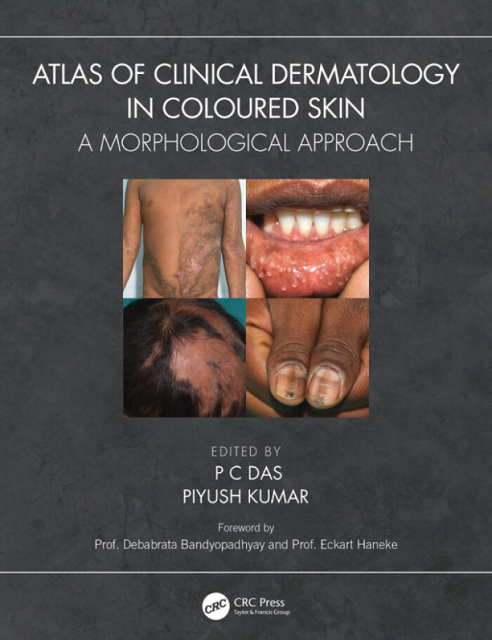 Atlas of Clinical Dermatology in Coloured Skin: A Morphological Approach