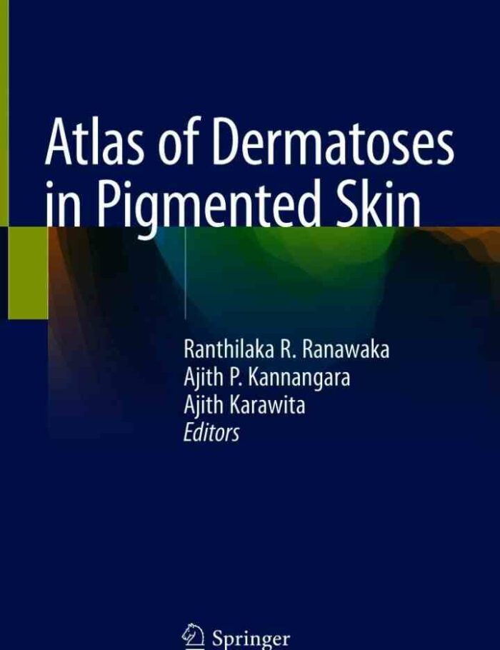Atlas of Dermatoses in Pigmented Skin
