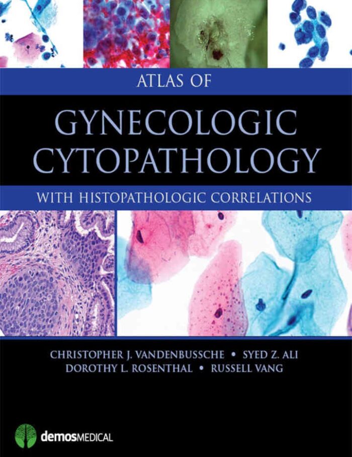 Atlas of Gynecologic Cytopathology: with Histopathologic Correlations