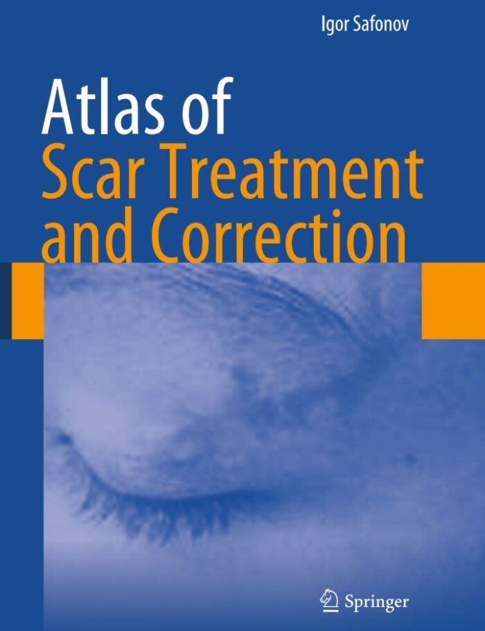 Atlas of Scar Treatment and Correction