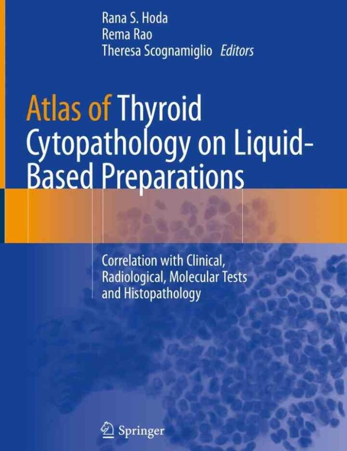 Atlas of Thyroid Cytopathology on Liquid-Based Preparations: Correlation with Clinical Radiological Molecular Tests and Histopathology