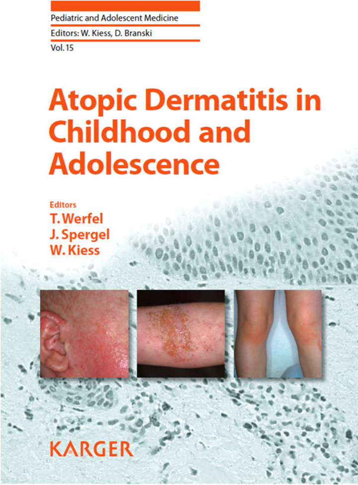 Atopic Dermatitis in Childhood and Adolescence