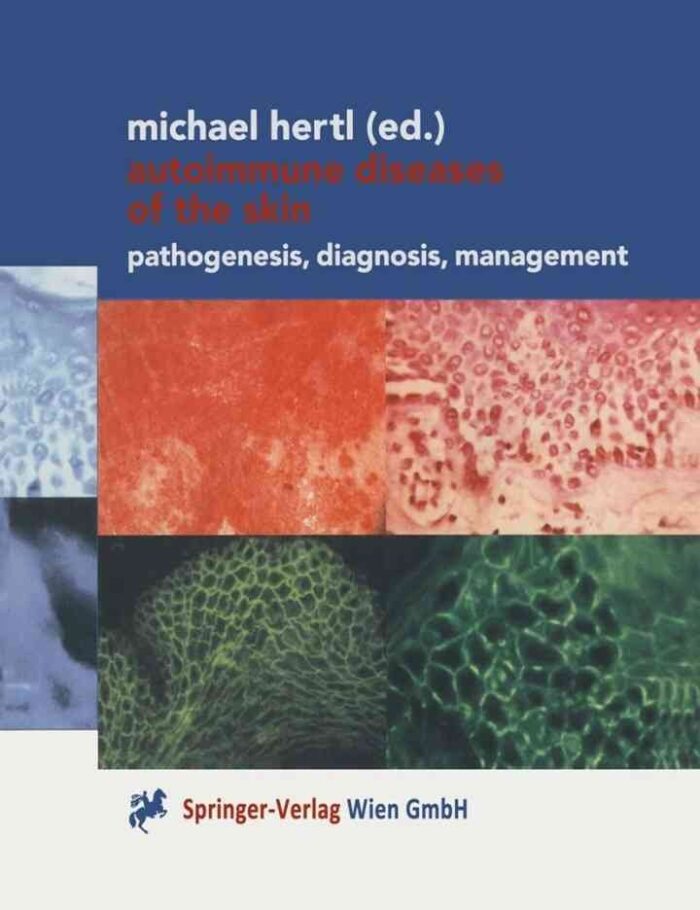Autoimmune Diseases of the Skin: Pathogenesis, Diagnosis, Management, 1st Edition