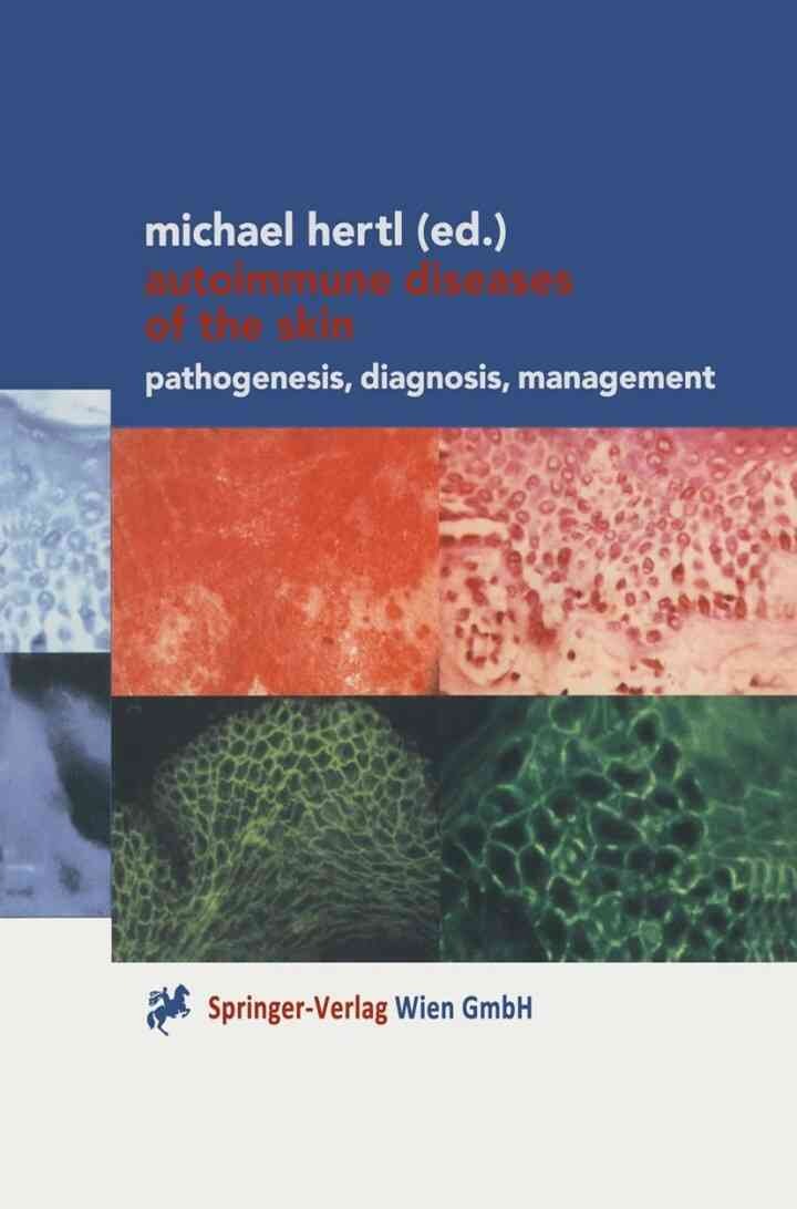 Autoimmune Diseases of the Skin: Pathogenesis, Diagnosis, Management, 1st Edition