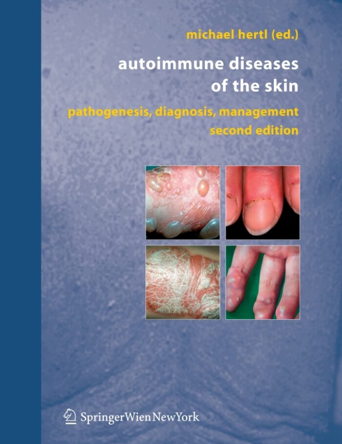 Autoimmune Diseases of the Skin: Pathogenesis Diagnosis Management