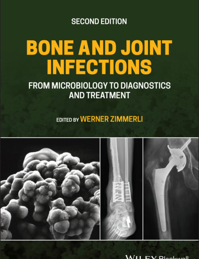 Bone and Joint Infections: From Microbiology to Diagnostics and Treatment