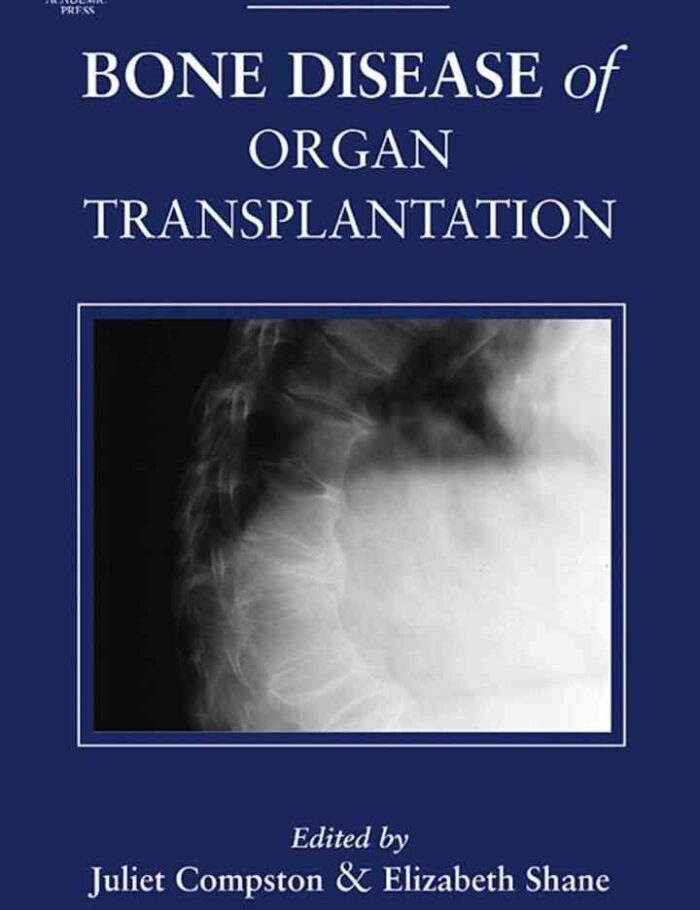 Bone Disease of Organ Transplantation