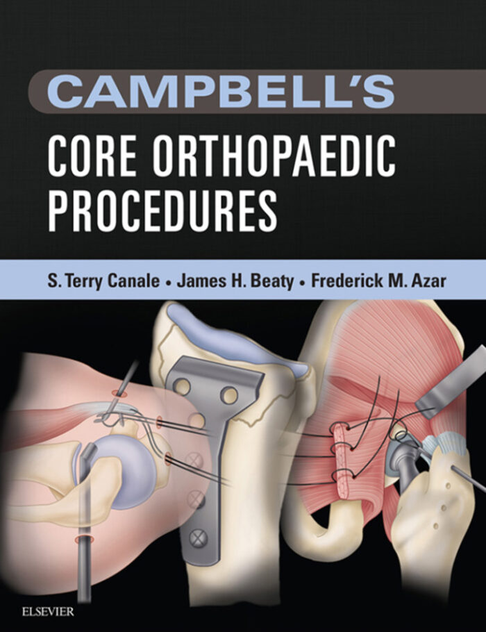 Campbell's Core Orthopaedic Procedures