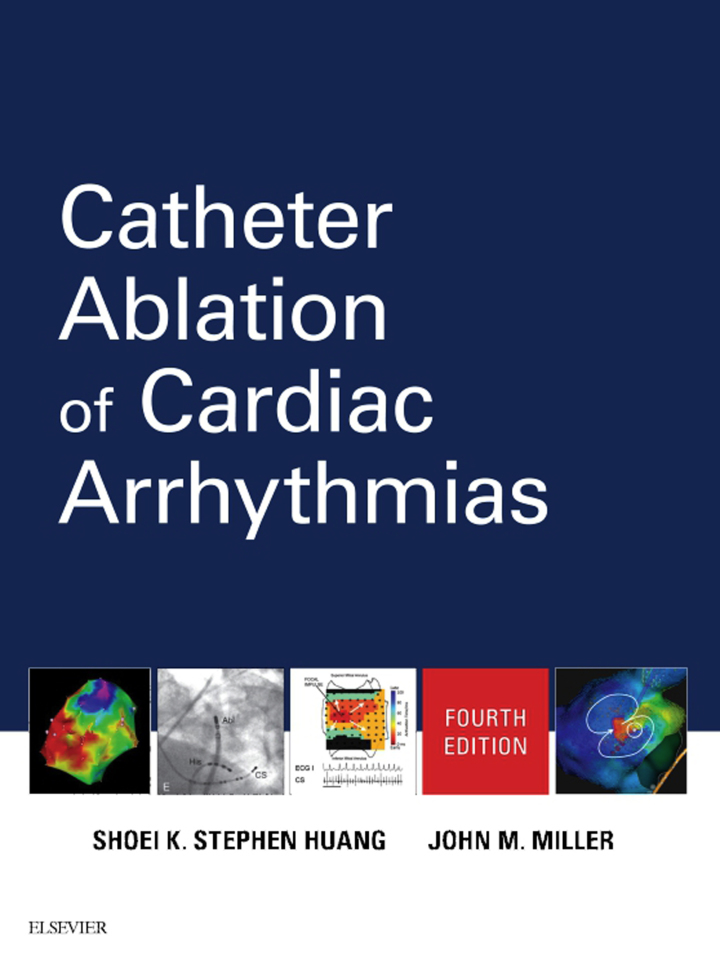Catheter Ablation of Cardiac Arrhythmias