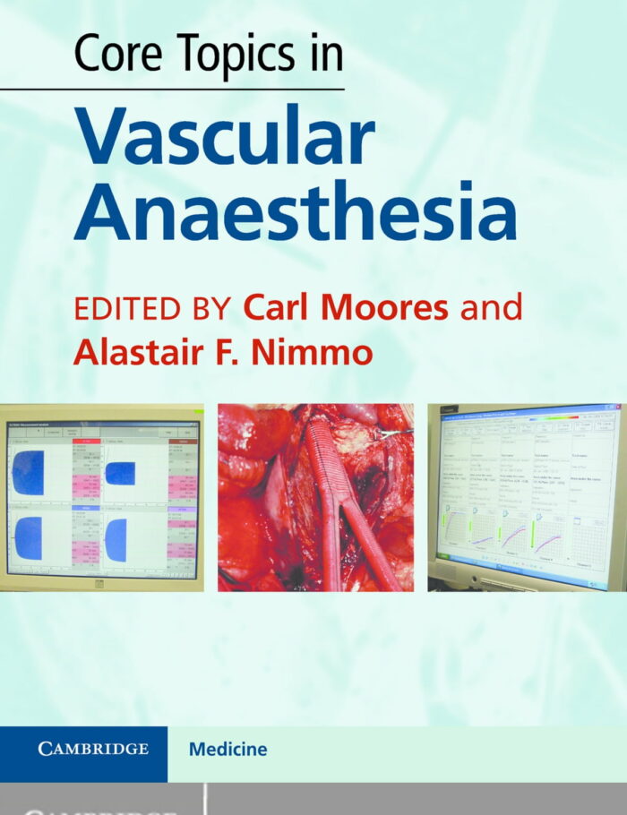Core Topics in Vascular Anaesthesia